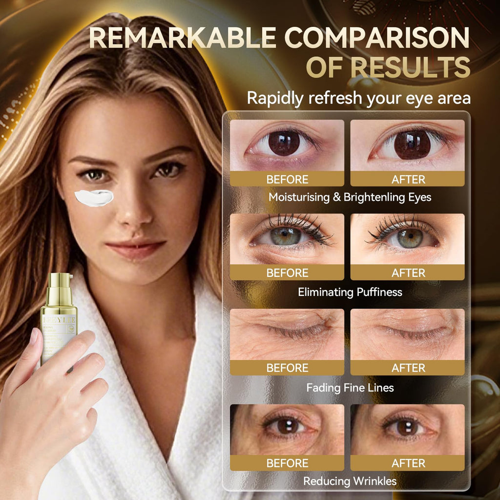 BREYLEE Aloe Vera Eye Masks– 60 Pcs - Puffy Eyes and Dark Circles Treatments – Look Younger and Reduce Wrinkles and Fine Lines Undereye, Improve and Firm eye Skin - Pure Natural Material Extraction