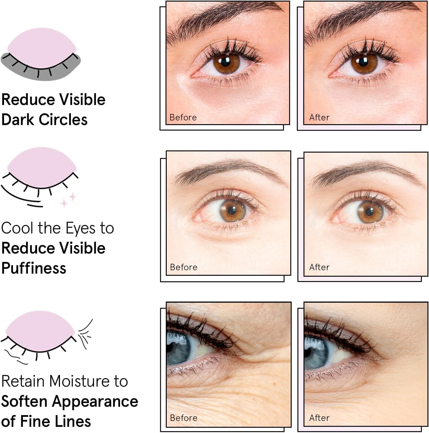 grace & stella Award Winning Under Eye Mask Reduce Dark Circles, Puffy Eyes, Undereye Bags, Wrinkles, Gel Under Eye Patches, New Mom Gifts - Vegan Self Care (48 Pairs, Blue)