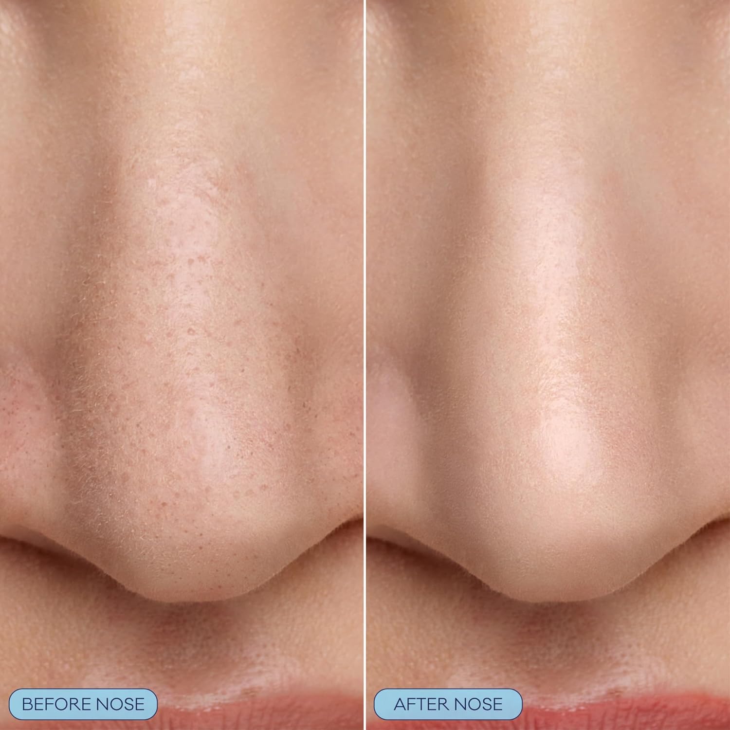 Biore Pore Refining Bubbling Nose Mask, Glycolic Acid and Hyaluronic Acid Exfoliant for Face, Pore Cleansing Mask, 8 Ct