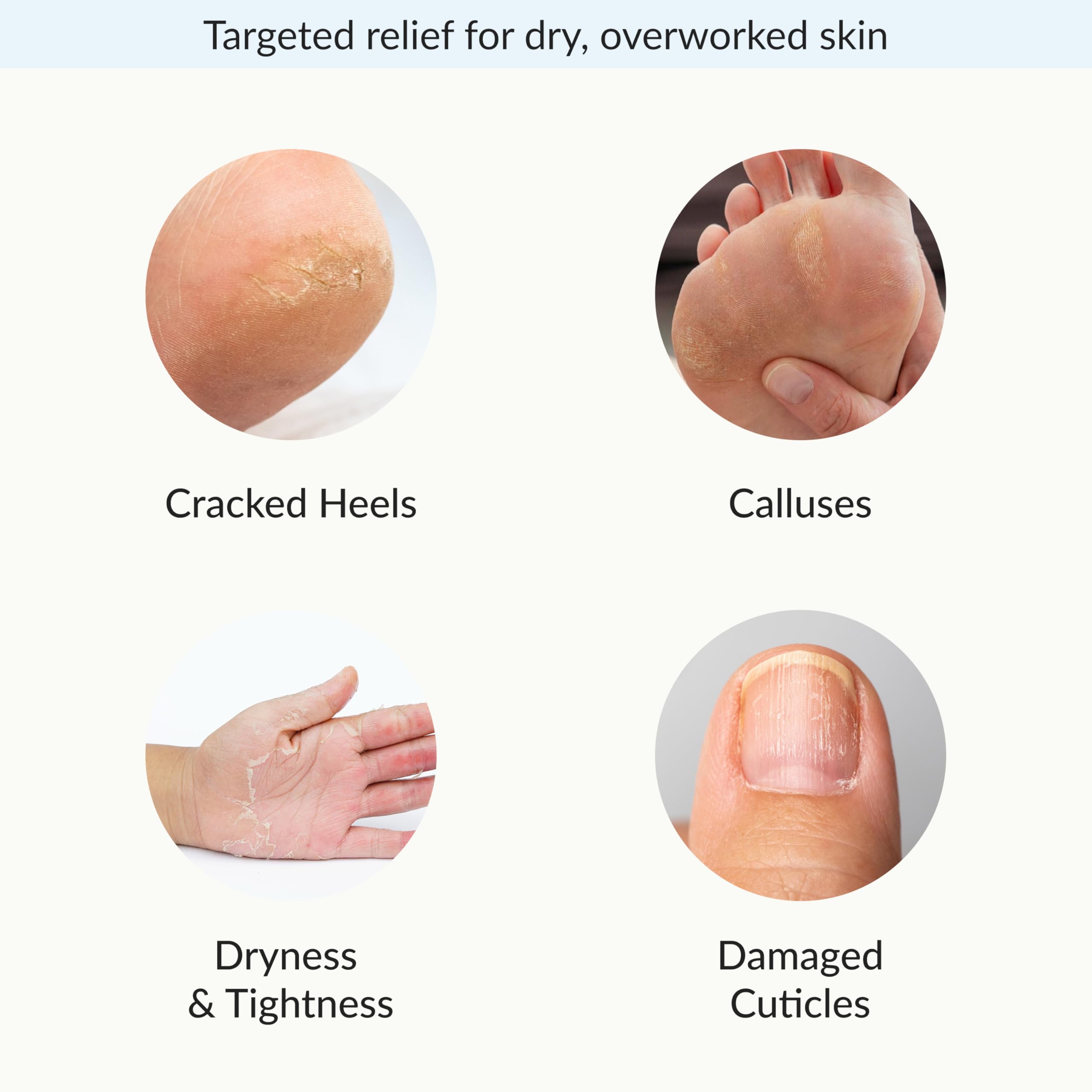 Epielle Intensive Repairing Hand & Foot Masks, Restore and Moisturize Dry, Cracked Skin, Self Care Gifts for Women, Spa Kit, 6 Moisturizing Gloves & 6 Moisturizing Socks