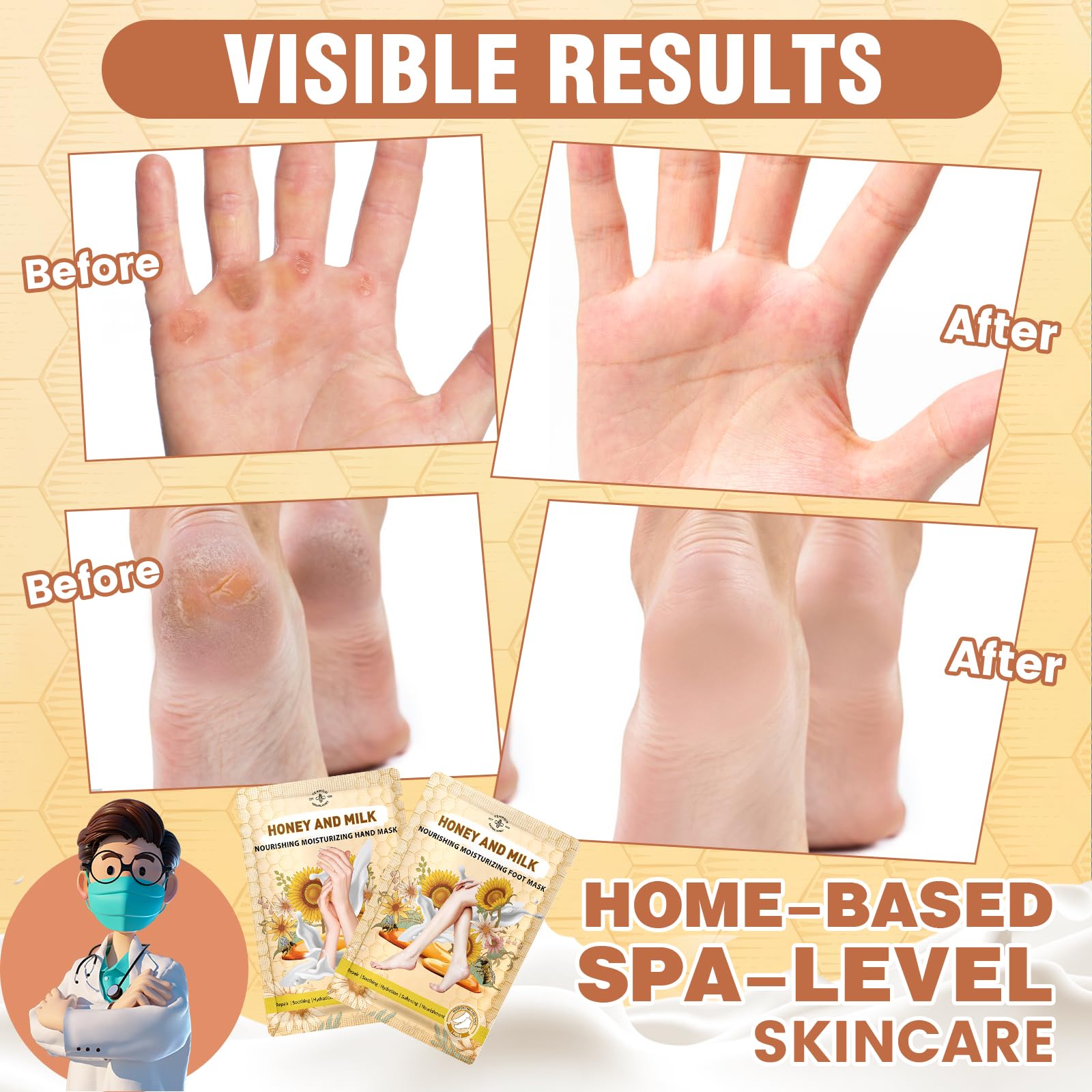 TEAWOO 18 Pairs Moisturizing Hand & Foot Masks with Honey, Milk, Vitamin E & Glycerin, Intensely Hydrating Foot Mask for Dry Cracked Feet, Moisturizing Socks for Cracked Heel Treatment