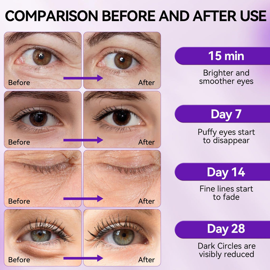 BREYLEE Aloe Vera Eye Masks– 60 Pcs - Puffy Eyes and Dark Circles Treatments – Look Younger and Reduce Wrinkles and Fine Lines Undereye, Improve and Firm eye Skin - Pure Natural Material Extraction